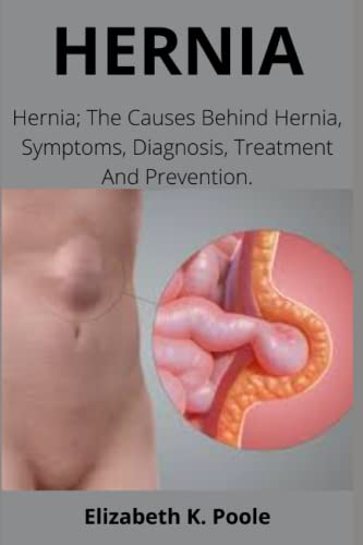 Imagen de archivo de HERNIA: Hernia; The Causes Behind Hernia, Symptoms, Diagnosis, Treatment And Prevention. a la venta por Brit Books