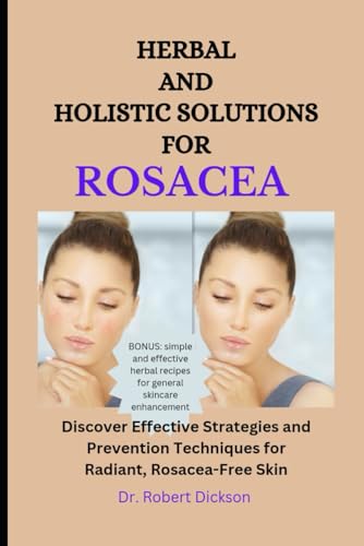 Stock image for Herbal and Holistic Solutions for Rosacea (Paperback) for sale by Grand Eagle Retail