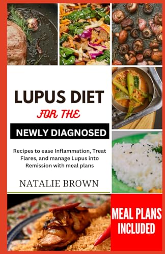 Beispielbild fr Lupus Diet for the Newly Diagnosed: Recipes to ease inflammation, Treat Flares and Manage lupus into remission with meal plans zum Verkauf von GreatBookPrices