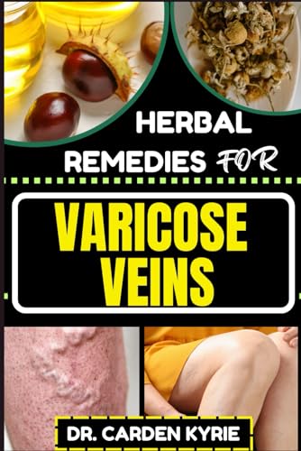 Stock image for Herbal Remedies for Varicose Veins: Empower Your Veins Naturally With Herbal Medicine For Holistic Wellness, Effective Relief And Vibrant Health for sale by GreatBookPrices