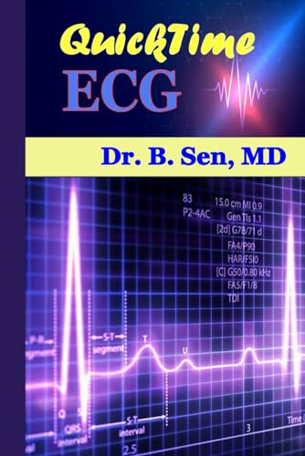 Beispielbild fr QUICKtime ECG: an essential guide to Heart zum Verkauf von Ria Christie Collections