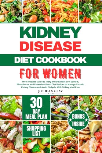 Beispielbild fr KIDNEY DISEASE DIET COOKBOOK FOR WOMEN: The Complete Guide to Tasty and Delicious Low Sodium, Phosphorus, and Potassium Renal Diet Recipes to Manage . and Avoid Dialysis, With 30 Day Meal Plan zum Verkauf von California Books