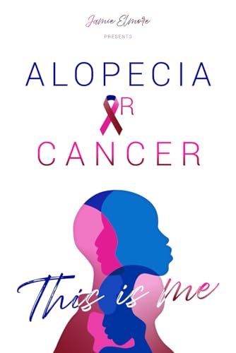 Stock image for Alopecia or Cancer: This is Me for sale by California Books