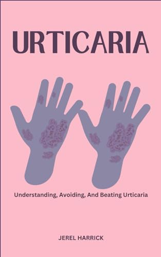 Beispielbild fr URTICARIA: Understanding, Avoiding, And Beating Urticaria zum Verkauf von California Books