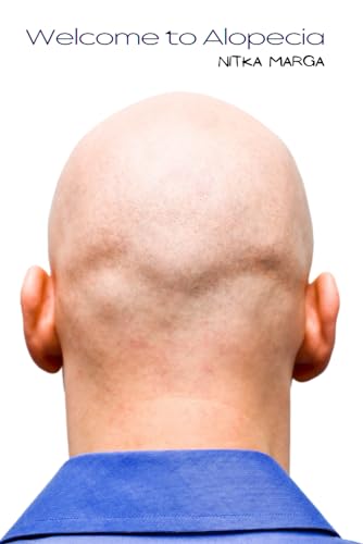 Stock image for Welcome to Alopecia for sale by PBShop.store US